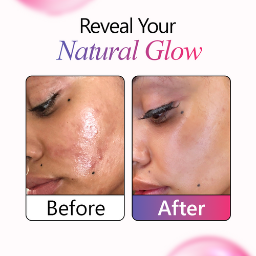 10% Azelaic Repair Serum